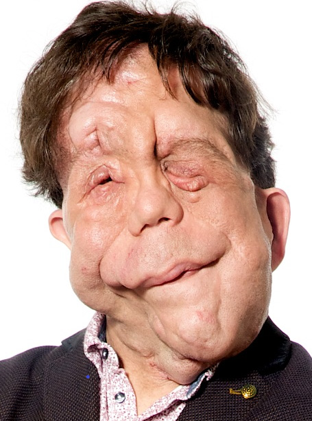 Adam Pearson